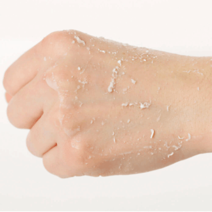 Ma:nyo Galactomy Enzyme Peeling Gel 75 ml. 3